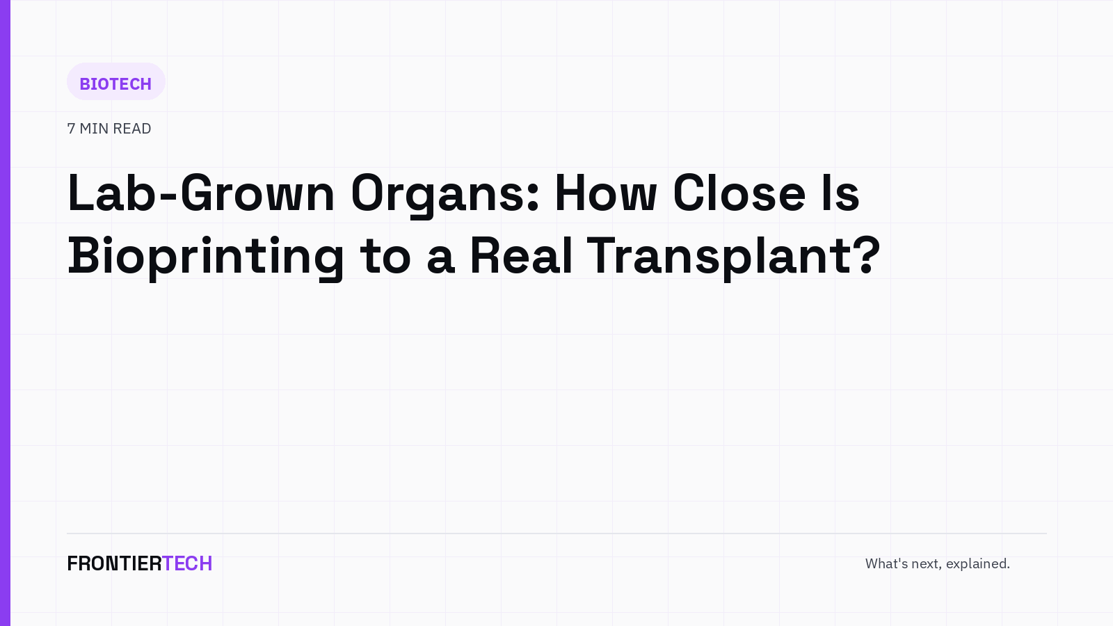 An illustration of a 3D bioprinter nozzle depositing layered tissue in the shape of an organ